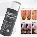 Esfoliante Facial OUHOE Cravos Acne/Remoção de Manchas - wonder store